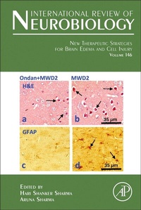 Abbildung von: New Therapeutic Strategies for Brain Edema and Cell Injury: Volume 146 - Academic Press