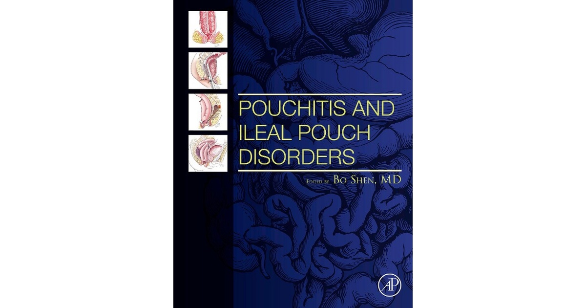 Pouchitis and Ileal Pouch Disorders Shen Schweitzer Fachinformationen