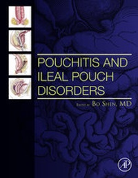 Pouchitis and Ileal Pouch Disorders - Shen - Schweitzer Fachinformationen