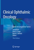 Cover: Clinical Ophthalmic Oncology - Springer