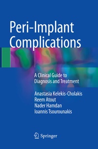 Abbildung von: Peri-Implant Complications - Springer