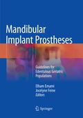 Cover: Mandibular Implant Prostheses - Springer