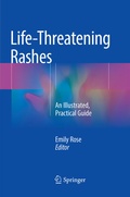 Cover: Life-Threatening Rashes - Springer