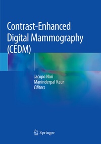 Abbildung von: Contrast-Enhanced Digital Mammography (CEDM) - Springer