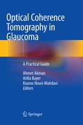 Cover: Optical Coherence Tomography in Glaucoma - Springer