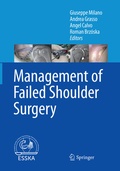 Cover: Management of Failed Shoulder Surgery - Springer