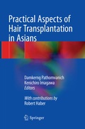 Cover: Practical Aspects of Hair Transplantation in Asians - Springer