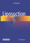 Cover: Liposuction - Springer