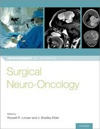 Abbildung von: Surgical Neuro-Oncology - OUP eBook