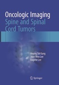 Cover: Oncologic Imaging: Spine and Spinal Cord Tumors - Springer