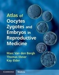 Cover: Atlas of Oocytes, Zygotes and Embryos in Reproductive Medicine Hardback with CD-ROM - Cambridge University Press