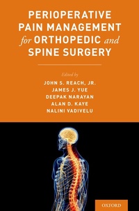 Abbildung von: Perioperative Pain Management for Orthopedic and Spine Surgery - OUP eBook