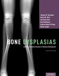 Abbildung von: Bone Dysplasias - OUP eBook