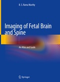 Abbildung von: Imaging of Fetal Brain and Spine - Springer