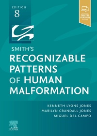 Abbildung von: Smith's Recognizable Patterns of Human Malformation - E-Book - Elsevier