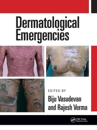 Enlarge image Cover: Dermatological Emergencies - CRC Press