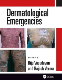 Enlarge image Cover: Dermatological Emergencies - CRC Press