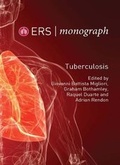 Cover: Tuberculosis - European Respiratory Society