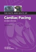 Cover: The Nuts and Bolts of Cardiac Pacing - Wiley