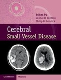 Cover: Cerebral Small Vessel Disease - Cambridge University Press