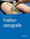 Cover: Fraktursonografie - Springer