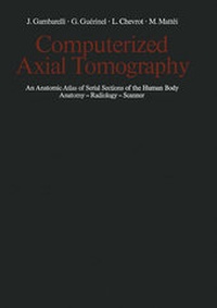 Enlarge image Cover: Computerized Axial Tomography - Springer