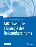 Cover: MRT-basierte Chirurgie des Rektumkarzinoms - Springer