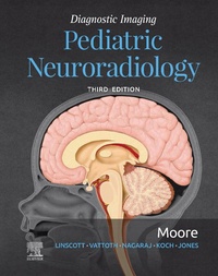 Abbildung von: Diagnostic Imaging: Pediatric Neuroradiology E-Book - Elsevier