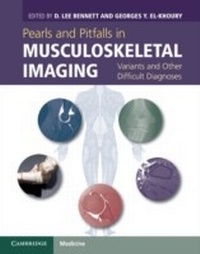 Abbildung von: Pearls and Pitfalls in Musculoskeletal Imaging - Cambridge University Press