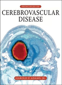 Enlarge image Cover: Principles of Cerebrovascular Disease - McGraw-Hill Medical