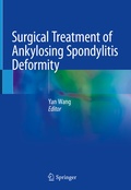 Cover: Surgical Treatment of Ankylosing Spondylitis Deformity - Springer