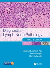 Enlarge image Cover: Diagnostic Lymph Node Pathology - CRC Press