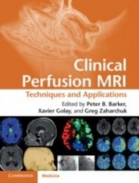 Abbildung von: Clinical Perfusion MRI - Cambridge University Press
