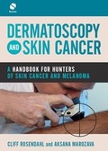 Cover: Dermatoscopy and Skin Cancer - Scion Publishing Ltd