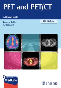 Abbildung von: PET and PET/CT - Thieme Publishers