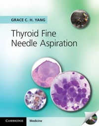 Abbildung von: Thyroid Fine Needle Aspiration - Cambridge University Press