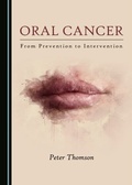 Cover: Oral Cancer - Cambridge Scholars Publishing