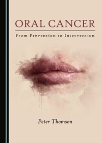 Abbildung von: Oral Cancer - Cambridge Scholars Publishing