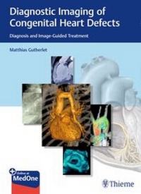 Abbildung von: Diagnostic Imaging of Congenital Heart Defects - Thieme