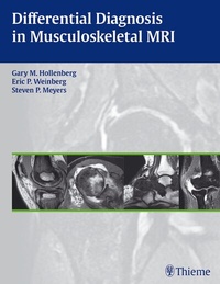 Abbildung von: Differential Diagnosis in Musculoskeletal MRI - Thieme Publishers