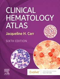 Abbildung von: Clinical Hematology Atlas - Elsevier