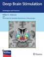 Cover: Deep Brain Stimulation - Thieme Publishers