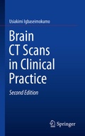 Bild: Brain CT Scans in Clinical Practice - Springer