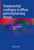 Bild: Transbronchial cryobiopsy in diffuse parenchymal lung disease - Springer