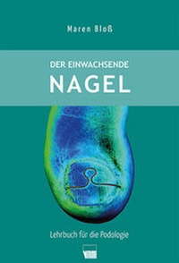 Abbildung von: Der einwachsende Nagel - Neuer Merkur