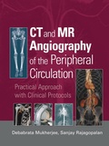 Cover: CT and MR Angiography of the Peripheral Circulation - CRC Press
