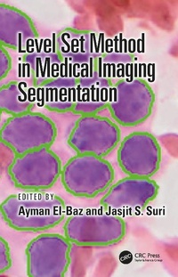 Abbildung von: Level Set Method in Medical Imaging Segmentation - CRC Press
