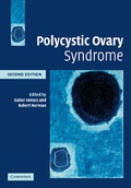 Cover: Polycystic Ovary Syndrome - Cambridge University Press
