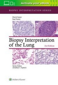 Abbildung von: Biopsy Interpretation of the Lung - WOLTERS KLUWER HEALTH
