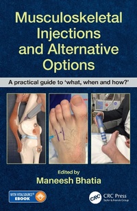 Abbildung von: Musculoskeletal Injections and Alternative Options - CRC Press